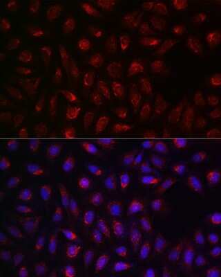 Immunocytochemistry/ Immunofluorescence: SDHA Antibody - Azide and BSA Free [NBP2-93922]
