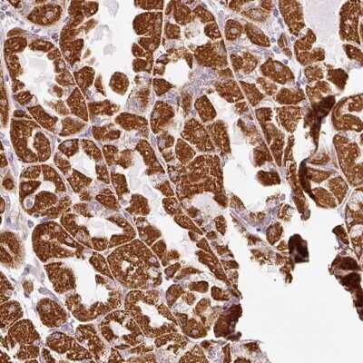 Immunohistochemistry-Paraffin: SDHA Antibody [NBP2-32594]