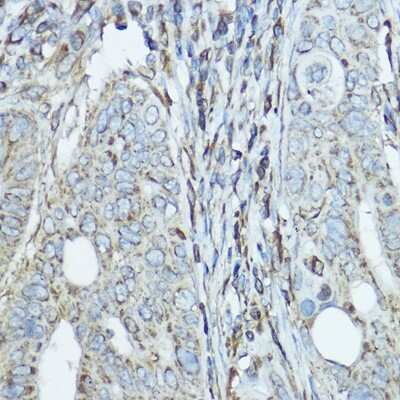 Immunohistochemistry-Paraffin: SDHA Antibody - Azide and BSA Free [NBP2-93922]