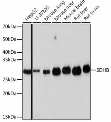 Western Blot: SDHB Antibody (9S1A0) [NBP3-15564]