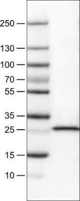 Western Blot: SDHB Antibody (CL0349) [NBP2-52921]