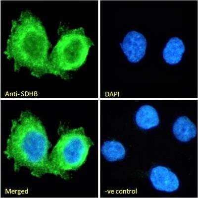 Immunocytochemistry/ Immunofluorescence: SDHB Antibody [NB600-793]