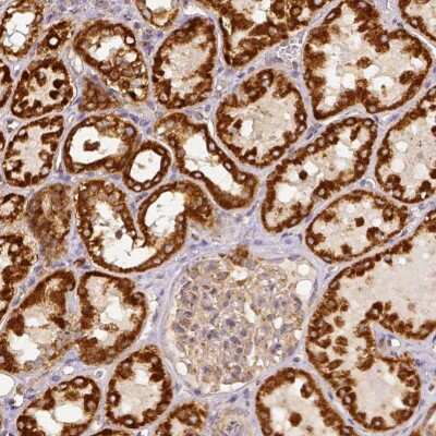 Immunohistochemistry-Paraffin: SDHB Antibody [NBP1-87069]