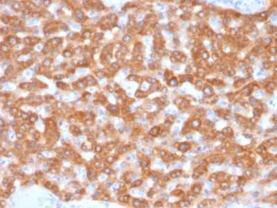 Immunohistochemistry-Paraffin: SDHB Antibody (SDHB/2126) - Azide and BSA Free [NBP3-08809]