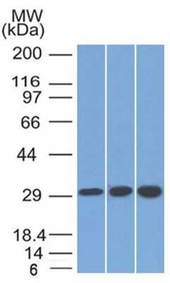 Western Blot: SDHB Antibody (SDHB/2126)Azide and BSA Free [NBP3-08809]