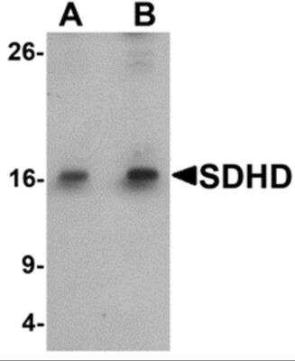 Western Blot: SDHD AntibodyBSA Free [NBP2-81948]