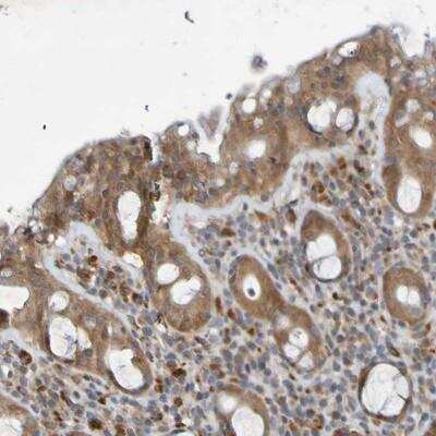 Immunohistochemistry-Paraffin: SDK1 Antibody [NBP1-93882]
