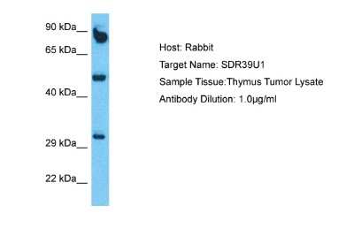 Western Blot: SDR39U1 Antibody [NBP2-85705]