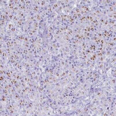 Immunohistochemistry-Paraffin: SDR42E2 Antibody [NBP2-32346]