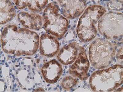Immunohistochemistry-Paraffin: SDR9C7 Antibody (OTI4B5) [NBP2-03030]