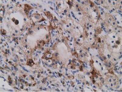 Immunohistochemistry: SDR9C7 Antibody (OTI4B5) - Azide and BSA Free [NBP2-74036]