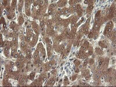 Immunohistochemistry: SDSL Antibody (OTI1A8) [NBP2-45978]