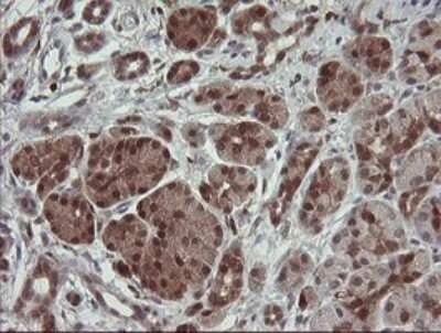 Immunohistochemistry: SDSL Antibody (OTI1A8) [NBP2-45978]