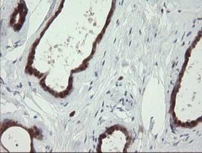 Immunohistochemistry: SDSL Antibody (OTI1A8) [NBP2-45978]