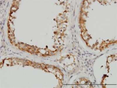 Immunohistochemistry-Paraffin: SDSL Antibody (M2) [H00113675-M02]