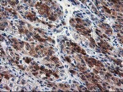 Immunohistochemistry-Paraffin: SEC14L2 Antibody (OTI4H2) [NBP2-01346]