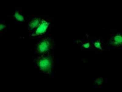 Immunocytochemistry/ Immunofluorescence: SEC14L2 Antibody (OTI4H2) - Azide and BSA Free [NBP2-74051]