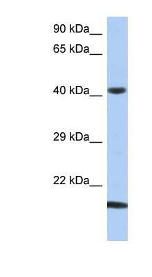 Western Blot: SEC14L4 Antibody [NBP1-57591]