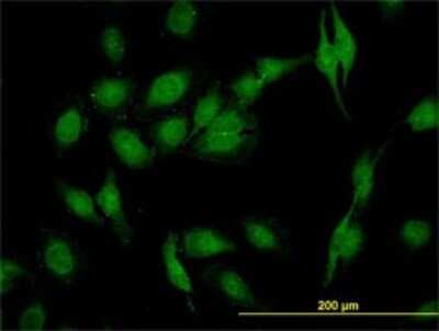 Immunocytochemistry/ Immunofluorescence: SEC22B Antibody (1E1) [H00009554-M01]