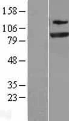 Western Blot: SEC23A Overexpression Lysate [NBL1-15777]