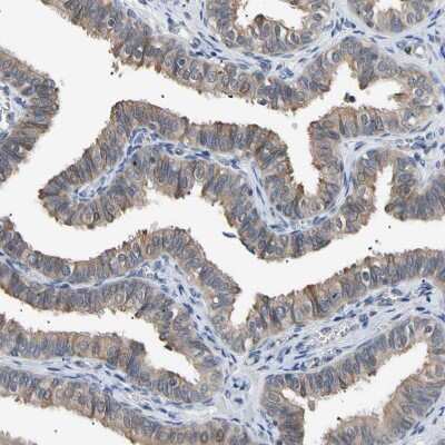 Immunohistochemistry-Paraffin: SEC23B Antibody [NBP1-85732]
