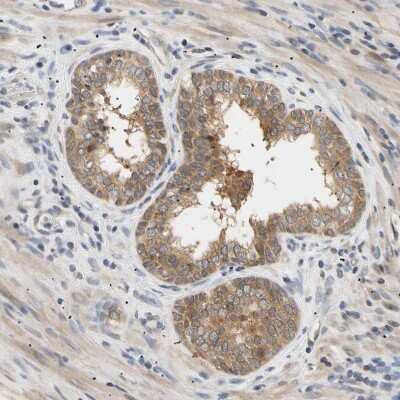 Immunohistochemistry-Paraffin: SEC23B Antibody [NBP1-85732]