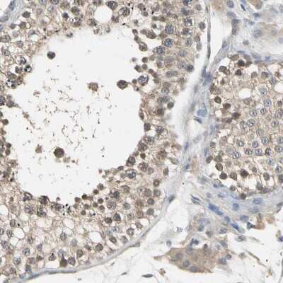 Immunohistochemistry-Paraffin: SEC23B Antibody [NBP1-85732]