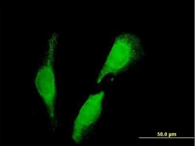 Immunocytochemistry/ Immunofluorescence: SEC23IP Antibody [H00011196-B01P]