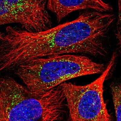 Immunocytochemistry/ Immunofluorescence: SEC23IP Antibody [NBP2-58361]