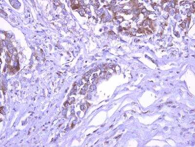 Immunohistochemistry-Paraffin: SEC3 Antibody [NBP2-20281]