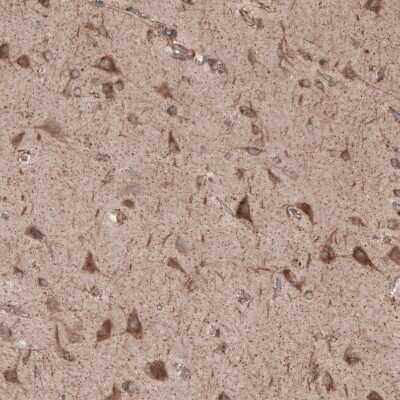 Immunohistochemistry-Paraffin: SEC31A Antibody [NBP1-89301]