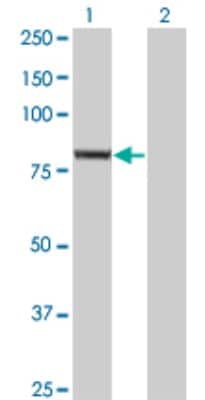 Western Blot: SEC6 Antibody (4A7) [H00011336-M01]