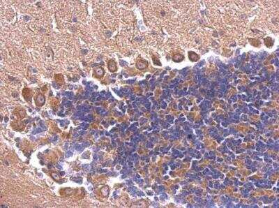 Immunohistochemistry-Paraffin: SEC6 Antibody [NBP2-20282]