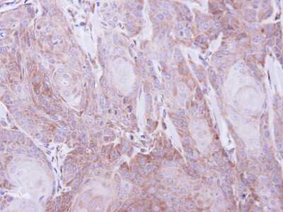 Immunohistochemistry-Paraffin: SEC61A Antibody [NBP1-31267]