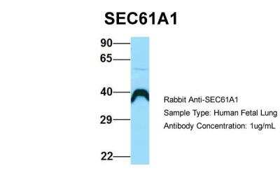 Western Blot: SEC61A Antibody [NBP2-86797]