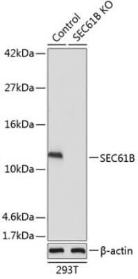 Knockout Validated: SEC61B Antibody - Azide and BSA Free [NBP2-93984]