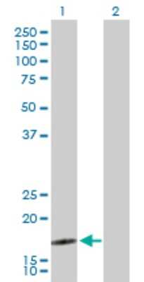 Western Blot: SEC61B Antibody [H00010952-D01P]