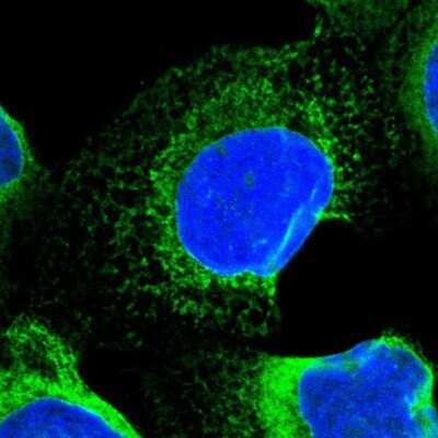 Immunocytochemistry/ Immunofluorescence: SEC62 Antibody [NBP1-84045]