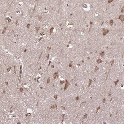 Immunohistochemistry: SEC62 Antibody [NBP2-38920]