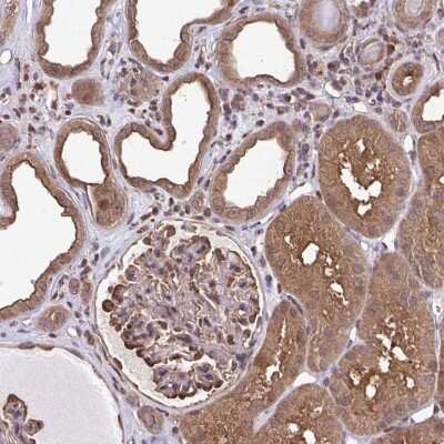 Immunohistochemistry: SEC63 Antibody [NBP2-38893]
