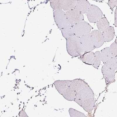 Immunohistochemistry-Paraffin: SEC63 Antibody [NBP2-30405]