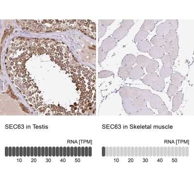 Immunohistochemistry-Paraffin: SEC63 Antibody [NBP2-30405]