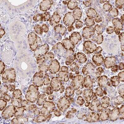 Immunohistochemistry-Paraffin: SEC63 Antibody [NBP2-30405]