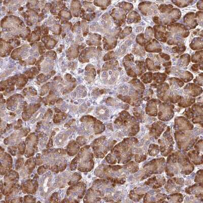 Immunohistochemistry-Paraffin: SEC63 Antibody [NBP2-30405]