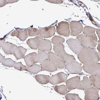 Immunohistochemistry-Paraffin: SEC63 Antibody [NBP2-38893]