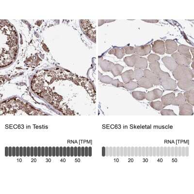 Immunohistochemistry-Paraffin: SEC63 Antibody [NBP2-38893]