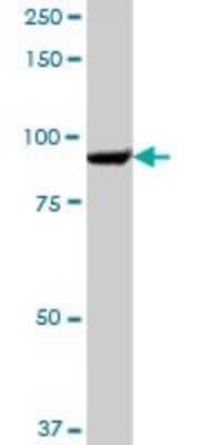 Western Blot: SEC63 Antibody [H00011231-B01P]