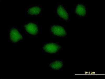 Immunocytochemistry/ Immunofluorescence: SECISBP2 Antibody [H00079048-B01P]
