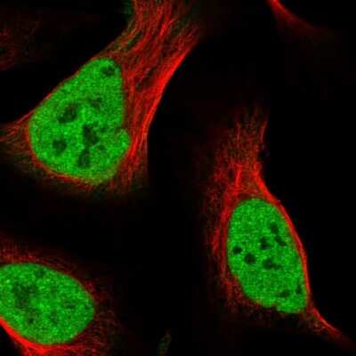 Immunocytochemistry/ Immunofluorescence: SECISBP2L Antibody [NBP1-81530]