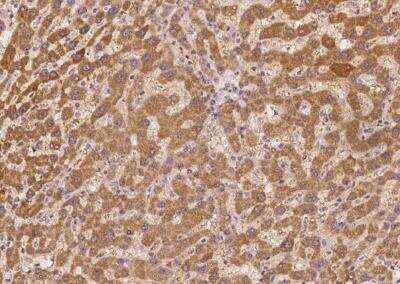 Immunohistochemistry-Paraffin: SECISBP2L Antibody [NBP3-05914]